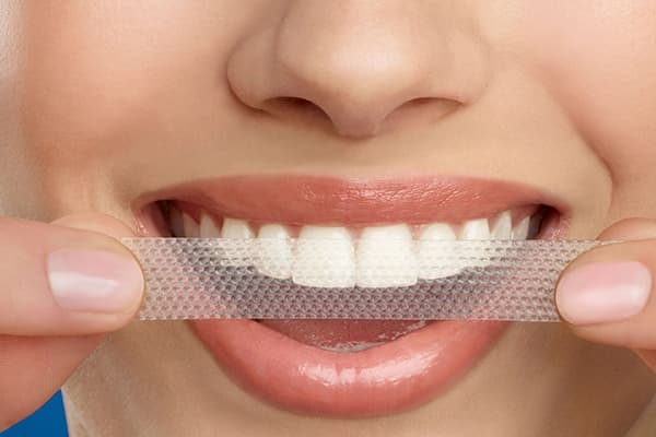Top-10-cele-mai-bune-produse-pentru-albirea-dintilor.jpg